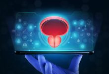 Qual a melhor opção de cirurgia a laser para próstatas de grande volume