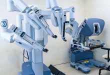 Como saber se a cirurgia robótica é indicada para mim