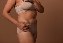 A cicatriz da abdominoplastia e o poder de se reencontrar