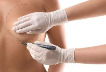 Ela achava que a recuperação seria um pesadelo