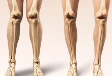 Seus joelhos estão alinhados Veja o que o formato das suas pernas pode revelar