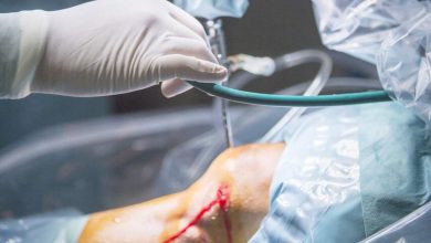 Sutura do menisco quando ela é indicada