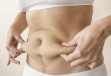 Se o medo da abdominoplastia vem do que você ouviu por aí, este post é pra você
